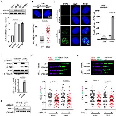 RECQ1 Promotes Stress Resistance and DNA Replication Progression Through PARP1 Signaling Pathway in Glioblastoma